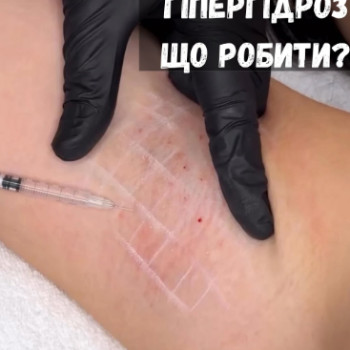Фото с портфолио Анастасія Міняйленко