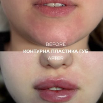 Фото с портфолио Анастасия Василак