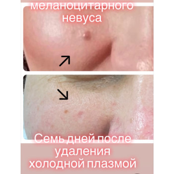 Фото с портфолио Ілона Єскіна