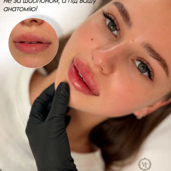 Вторинне збільшення губ Робота «До» не моя!