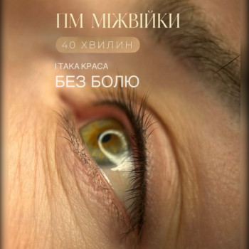Міжвійка Без болю -40 хвилин