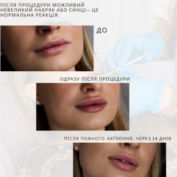 Фото с портфолио Mood