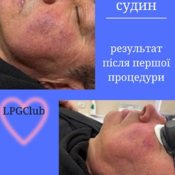 Фото с портфолио LPGClub