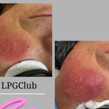 Фото с портфолио LPGClub