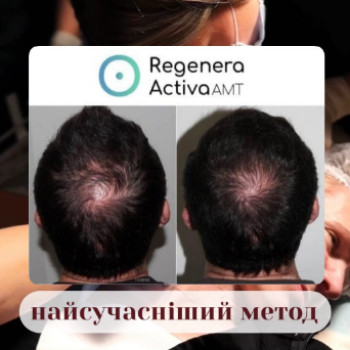 Фото с портфолио Клініка здоров'я та краси Поза часом