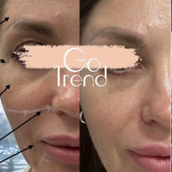 Фото с портфолио GoTrend Beauty