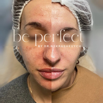 Фото с портфолио Be Perfect