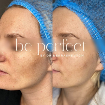 Фото с портфолио Be Perfect