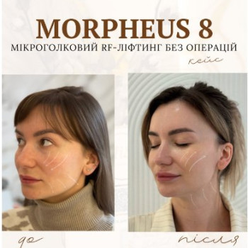 Фото с портфолио MiSo