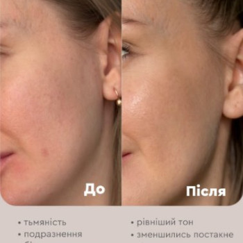 Фото с портфолио Piel Cosmetics