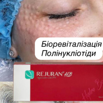 Фото с портфолио Lazer Room
