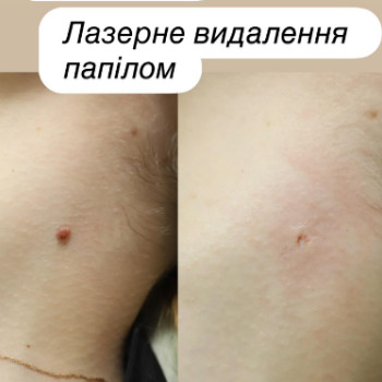 Фото с портфолио Lazer Room