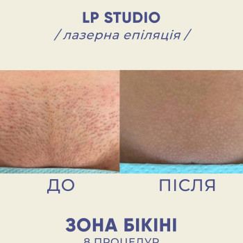 Фото с портфолио LP Studio