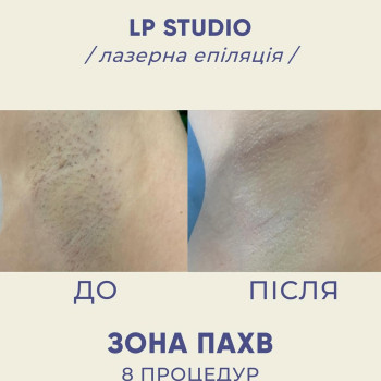 Фото с портфолио LP Studio