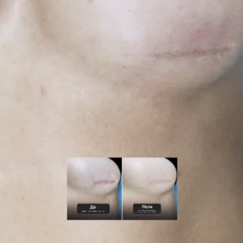 Фото с портфолио Coolaser Clinic