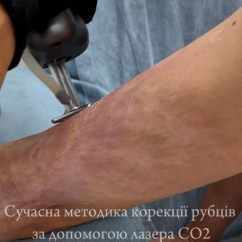 Фото с портфолио Coolaser Clinic