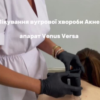 Фото с портфолио Coolaser Clinic
