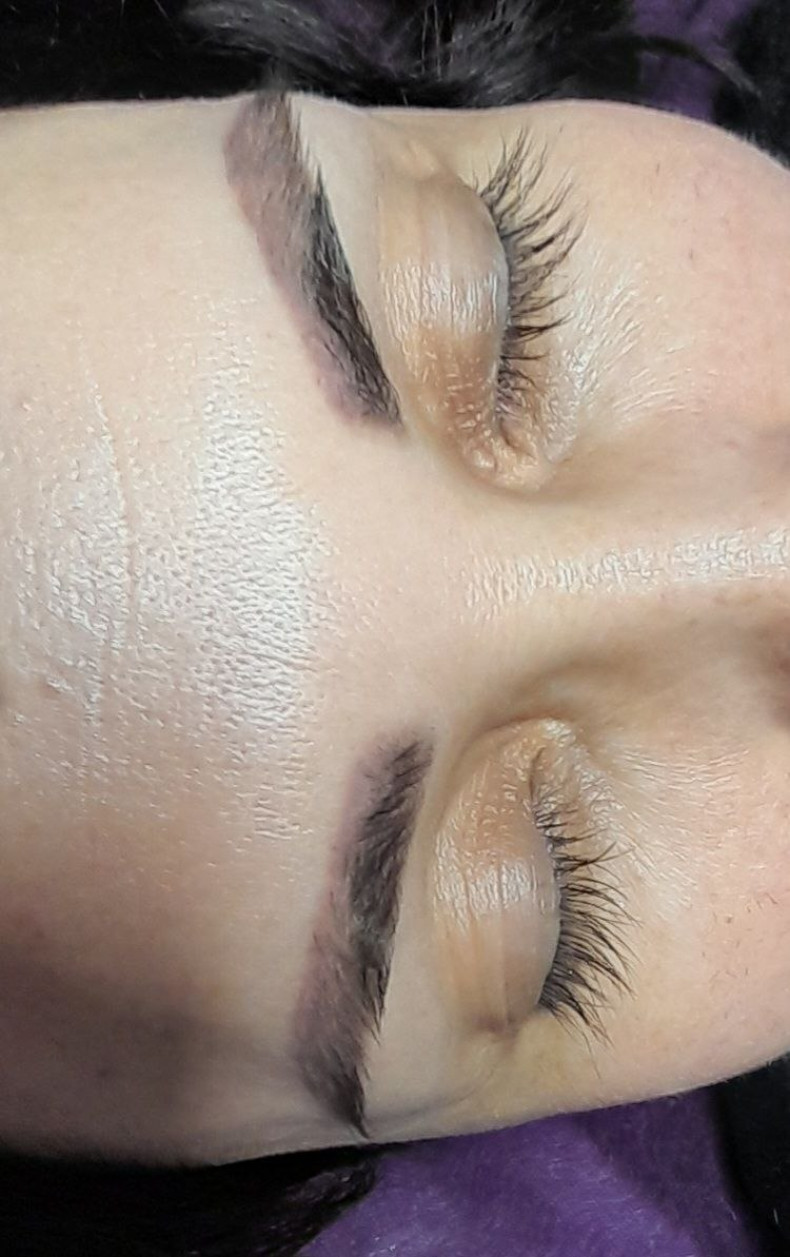 Видалення татуажу брів до, фото - Студия красоты Cosmeja