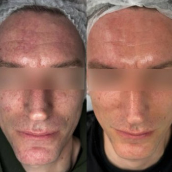Фото с портфолио Dr. Nikrasova Beauty Salon