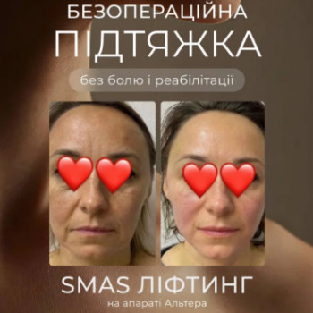 Фото с портфолио Наталья 