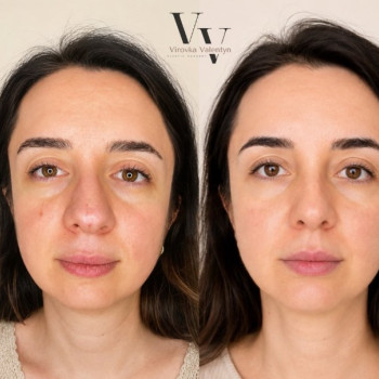 Фото с портфолио Virovka V&R beauty place