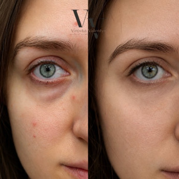 Фото с портфолио Virovka V&R beauty place