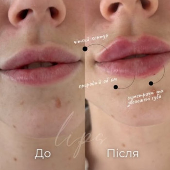 Фото с портфолио Dinastia Aesthetic