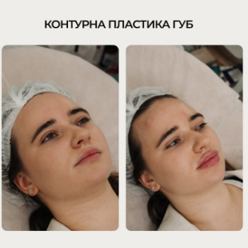 Фото с портфолио Леся Корнієнко