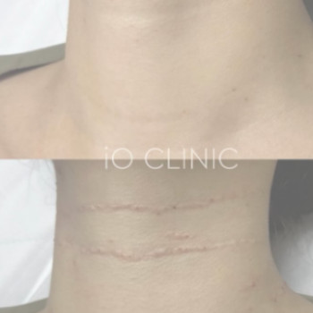 Фото с портфолио iO Clinic