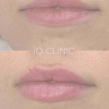 Фото с портфолио iO Clinic