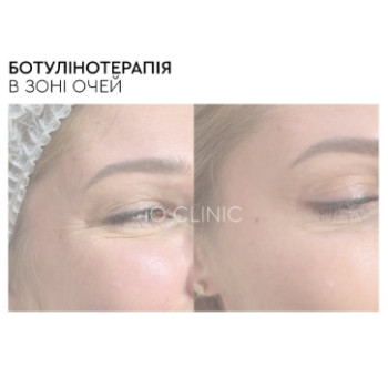 Фото с портфолио iO Clinic