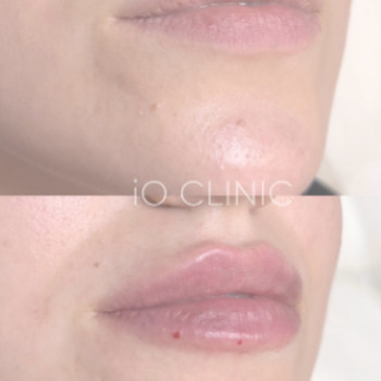 Фото с портфолио iO Clinic