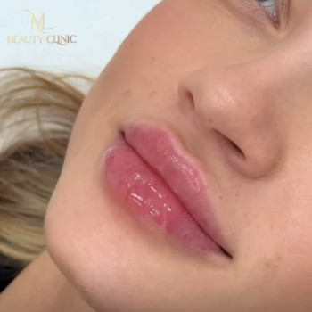 Фото с портфолио ML Beauty Clinic