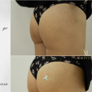 Фото с портфолио ML Beauty Clinic