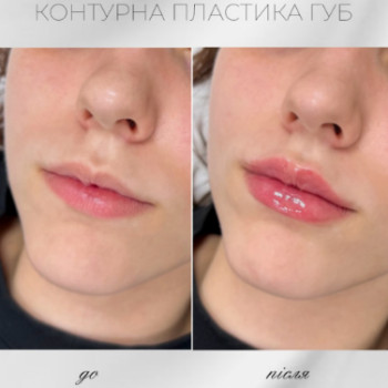 Фото с портфолио ML Beauty Clinic