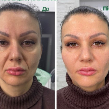 Фото с портфолио Woman Care