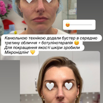 Фото с портфолио Досконала
