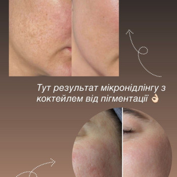 Фото с портфолио Doskonala