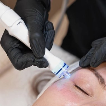 Фото с портфолио Idelis