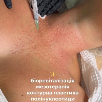 Фото с портфолио Idelis
