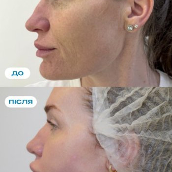 Фото с портфолио DG Cosmetology
