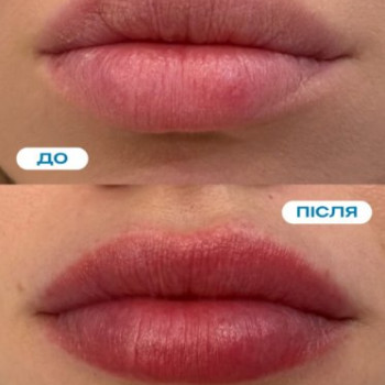 Фото с портфолио DG Cosmetology