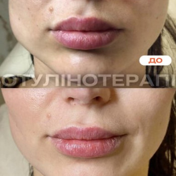 Фото с портфолио DG Cosmetology