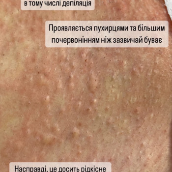Фото с портфолио Тетяна Балабаннікова