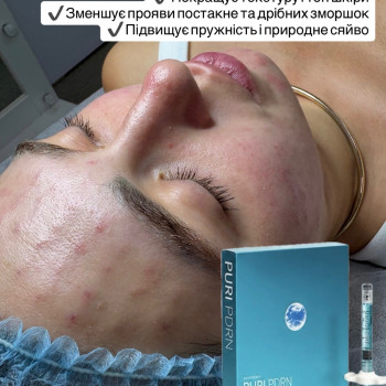 Фото с портфолио Яна Соловйова