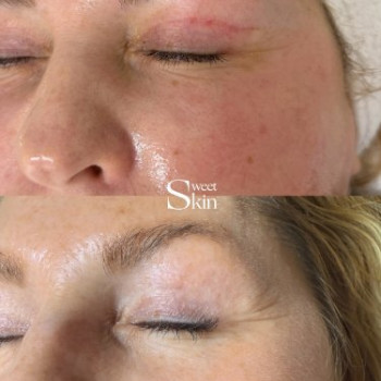 Фото с портфолио Sweet Skin