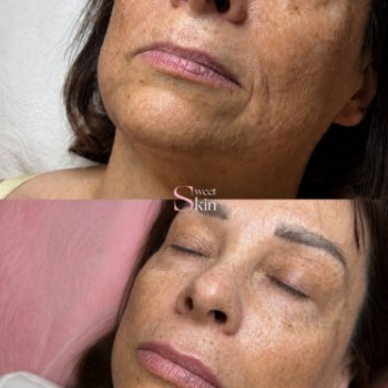 Фото с портфолио Sweet Skin