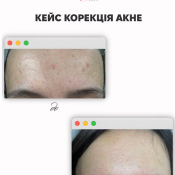 Фото с портфолио Sweet Skin