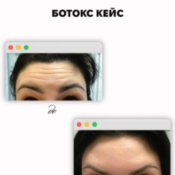 Фото с портфолио Sweet Skin
