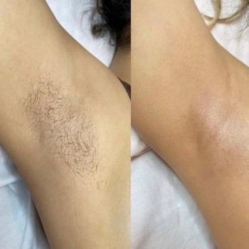 Фото с портфолио Юлия Шугаринг